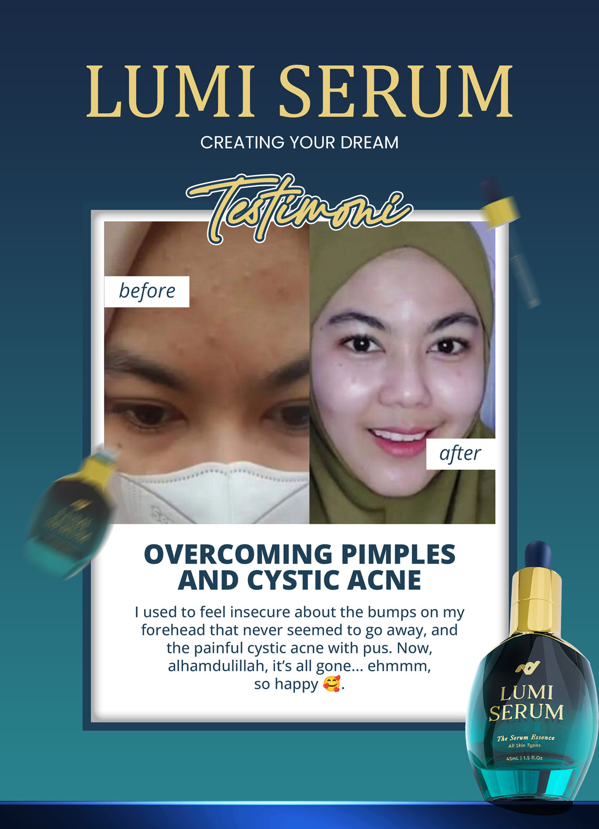 testi